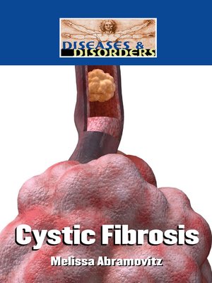 cover image of Cystic Fibrosis